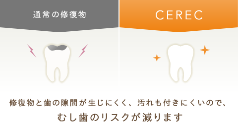 むし歯に再感染するリスクを軽減！