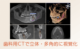 精密な検査