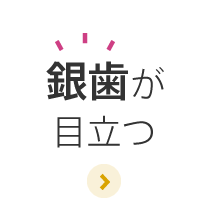 銀歯が目立つ